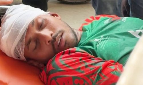 মাথায় আঘাতপ্রাপ্ত রোমান। ছবি: সংগৃহীত