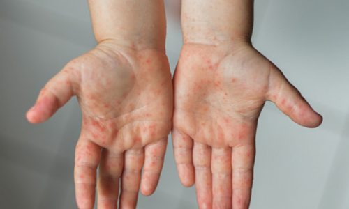 ছবি: সংগৃহীত।