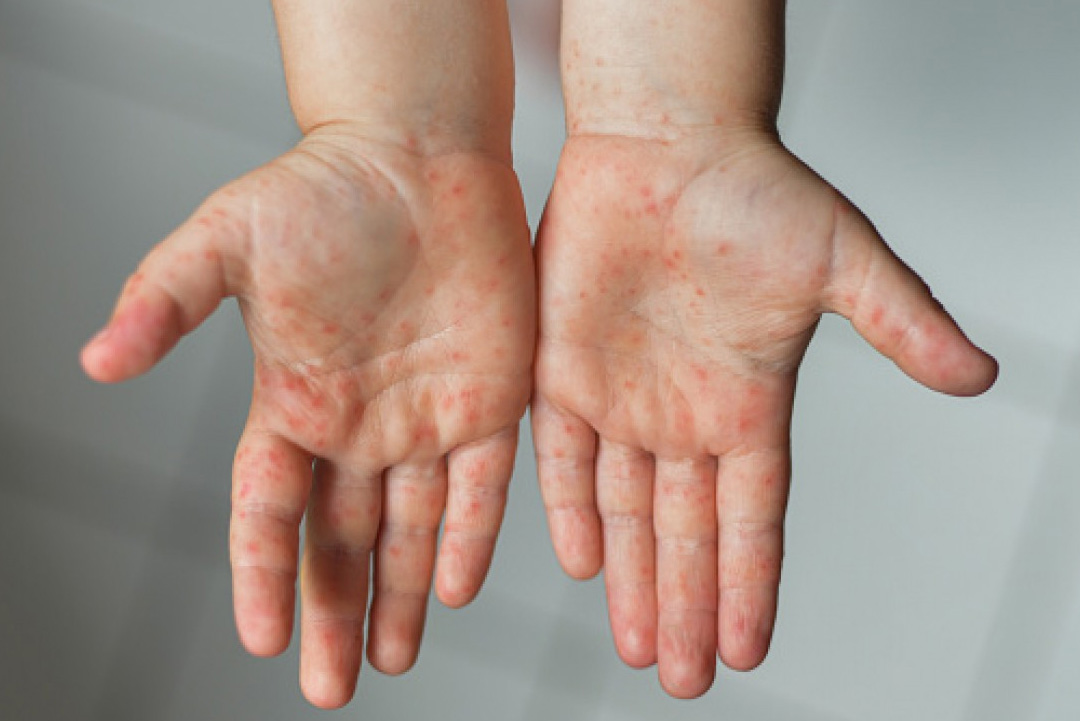 ছবি: সংগৃহীত।