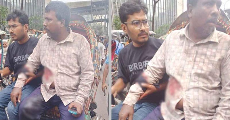 আহত ব্যাক্তি